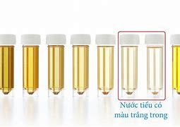 Uống Nước Tiểu Của Mình Có Tốt Không